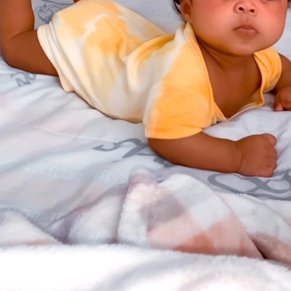 Yellow tie dye onesie - Picture 3 of 3